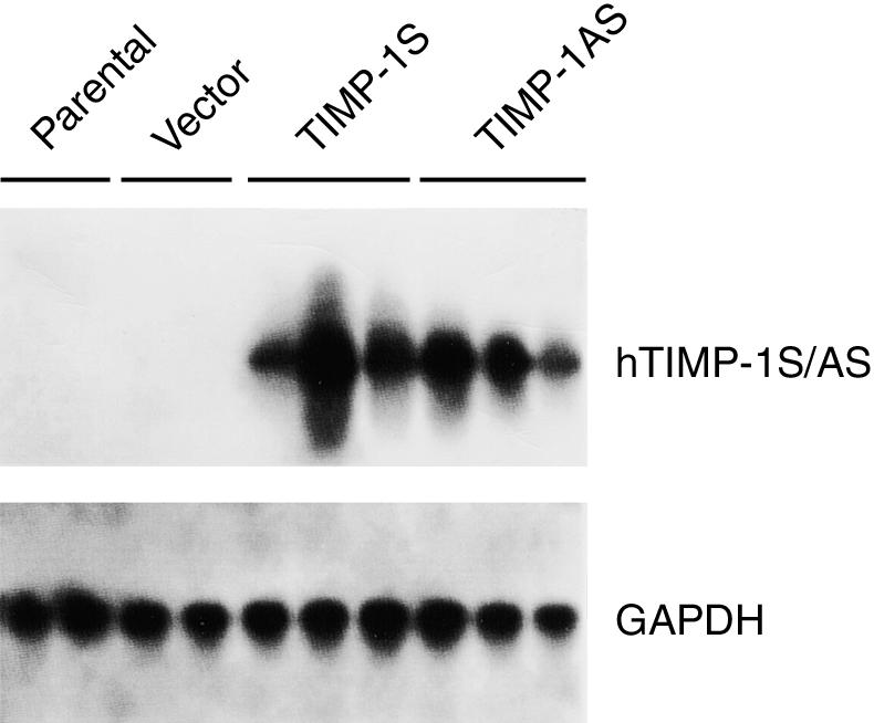 oligo (dt) primer (A), or downstream TIMP-1 primer (B). TIMP-1S/MC express sense human TIMP-1, while TIMP-1 AS/MC specifically express antisense TIMP-1. Lane 1 was the size marker.