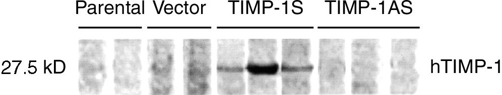 64 Lin et al: Apoptosis inhibition by TIMP-1 Fig. 4. Expression of TIMP-1 protein detected by Western blotting.