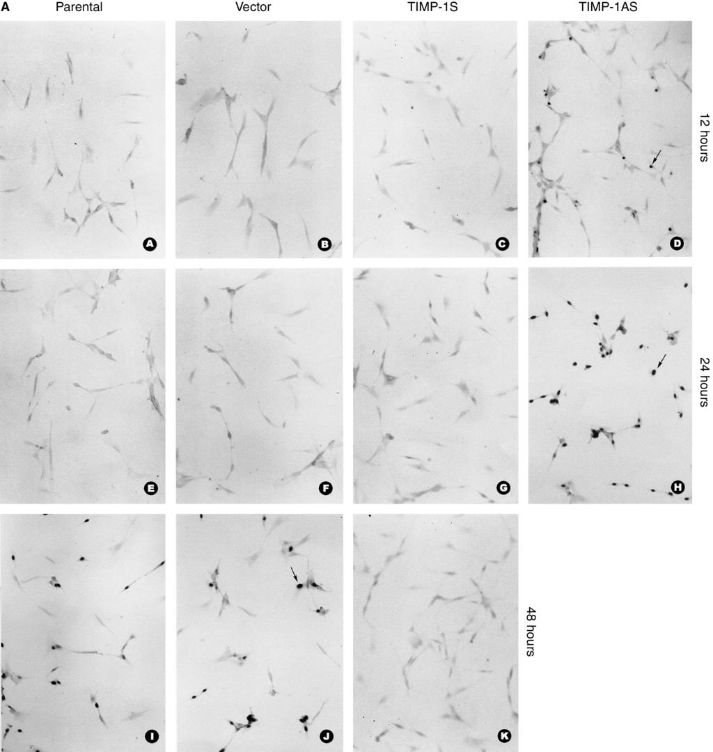 66 Lin et al: Apoptosis inhibition by TIMP-1 Fig. 6. (A) Effects of sense and antisense TIMP-1 on apoptosis in RMC induced by serum deprivation: TUNEL staining detecting the apoptosis.