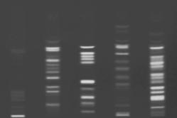 ProteoChrom HPTLC plates Tryptic digests of various proteins were separated on a ProteoChrom HPTLC Silica gel 60 F 254s plate followed by either (chromaticity of the pictures was modified): 25 (A)