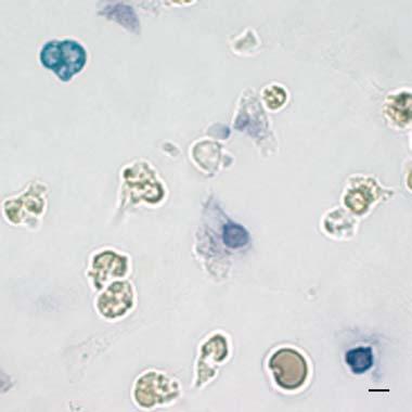 Cell Tissue Res (2008) 334:305 317 313 Fig. 6 In situ hybridization assay of transverse sections of the body wall and of hemocytes from C.