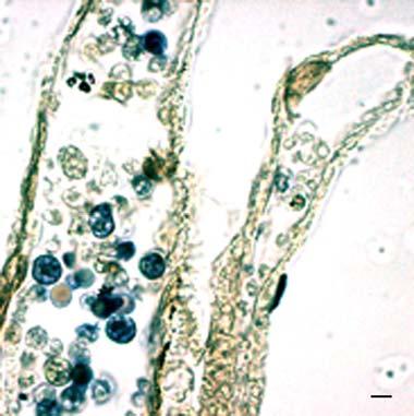 histological sections of the body wall showed that granular amoebocytes, which infiltrated the inflamed tunic (Fig.