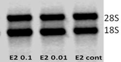 Effect of Maternal Estradiol Hormone on Gene Expression 149 RESULTS AND DISCUSSIONS The quality of RNA was identified by running the extracted RNA samples through agarose gel electrophoresis by