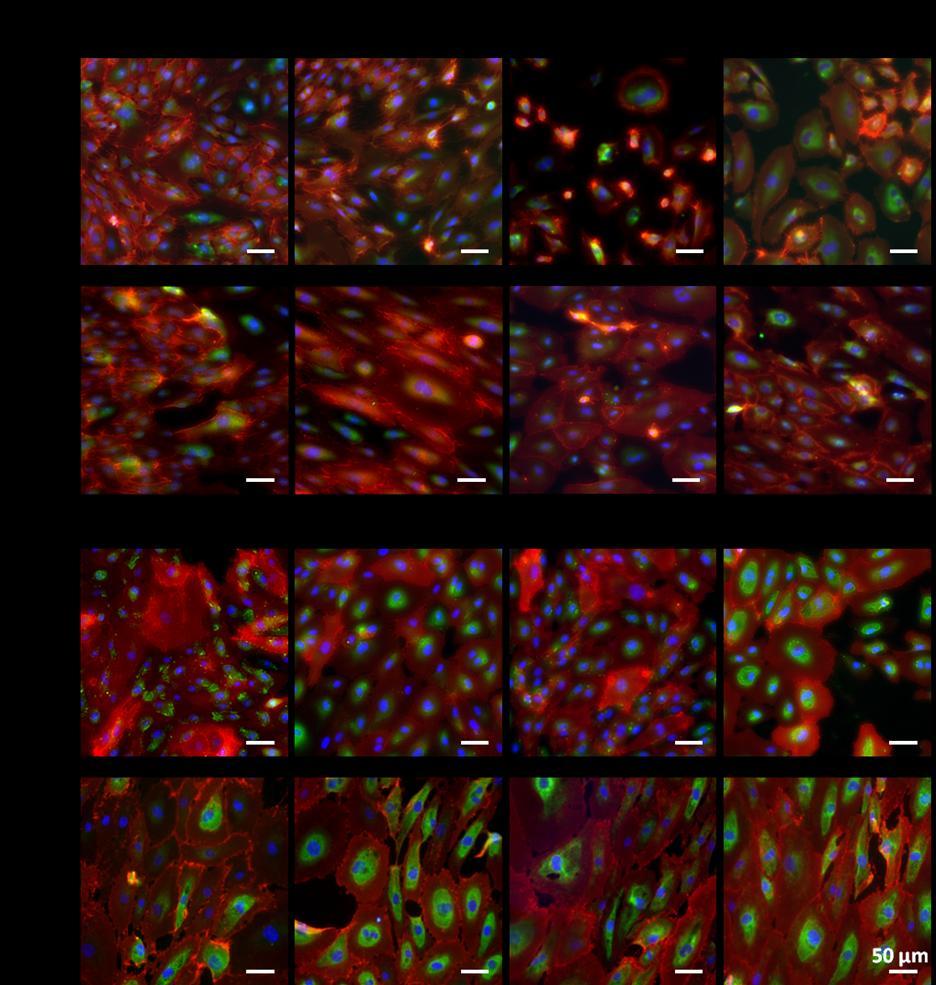 Chapter 3 Figure 3.6: immunofluorescent images of ECFC cultured in different environmental conditions and stained for CD31 (red), αsma (green) and nucleus (blue).
