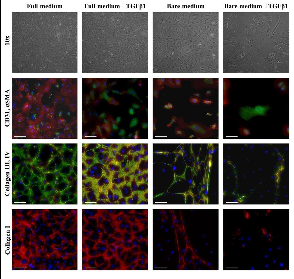 Matrix production and organization in strained fibrin gels Figure 4.7: Phase contrast and immunofluorescent images of ECFCs cultured for 14 days on coverglasses in different media.