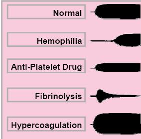formed by the interaction of platelets, coagulation factors, inhibitors, and fibrinolytic proteins.