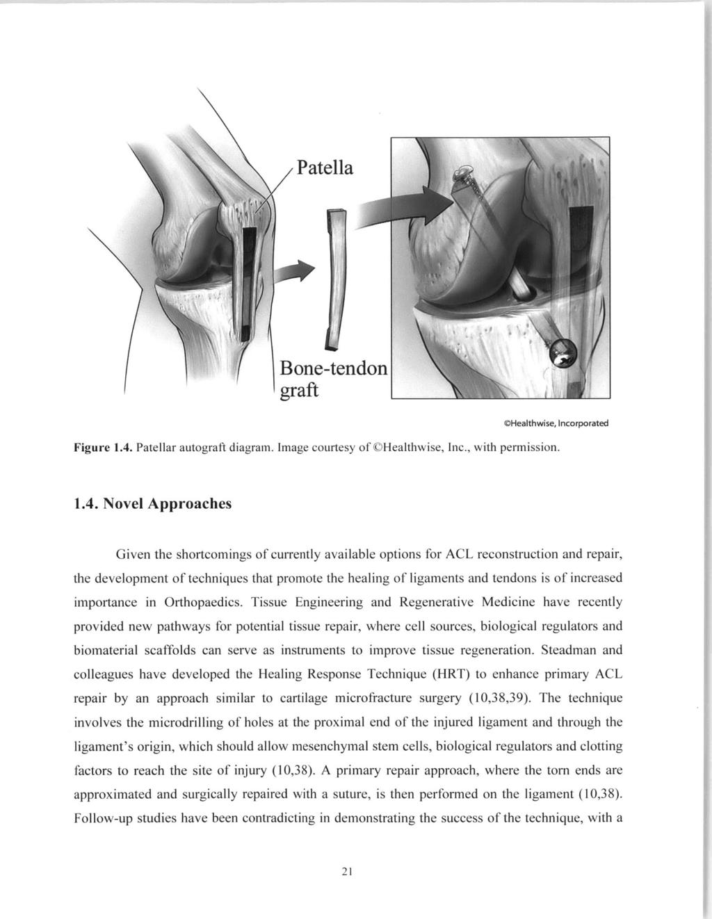 Patella Bone-tendon graft CHealthwise, Incorporated Figure 1.4.