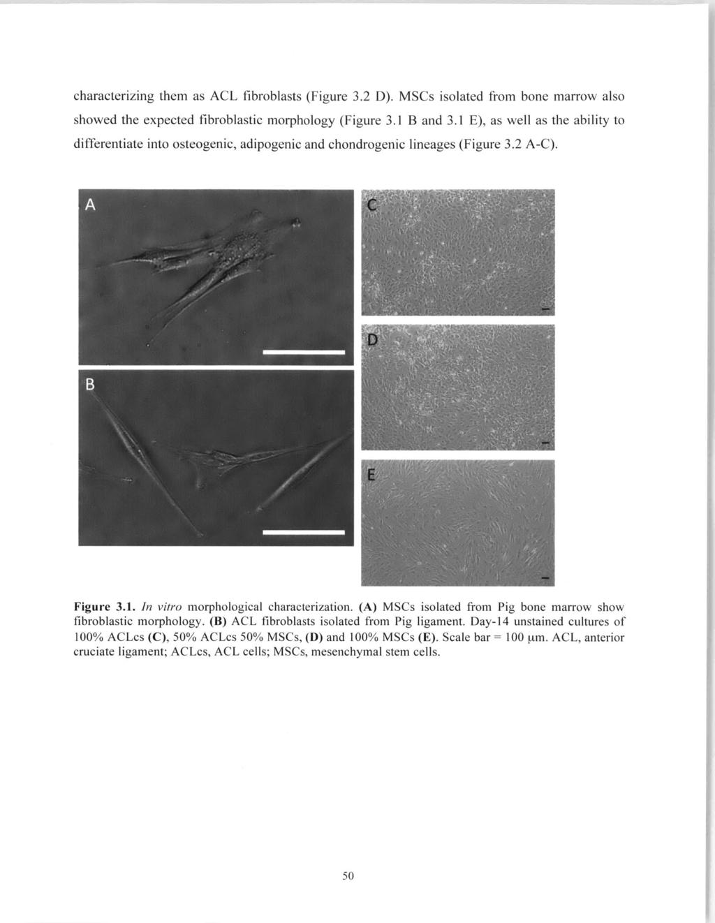 characterizing them as ACL fibroblasts (Figure 3.2 D). MSCs isolated from bone marrow also showed the expected fibroblastic morphology (Figure 3.1 B and 3.
