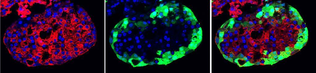 IMIDIA delivers a world first driven by SME involvement IMIDIA generated the first human pancreatic beta cell line A French SME was at the heart of the research Thanks to this