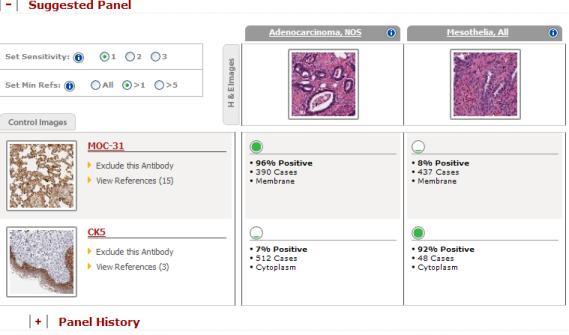 From this panel you can: Click Exclude this Antibody if you don t want to include the antibody in the analysis.