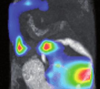 Habibollahi, MGH, Boston, Massachusetts, USA MR/bioluminescence Imaging of ovarian