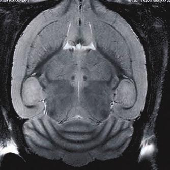 Neurology High resolution brain imaging at the
