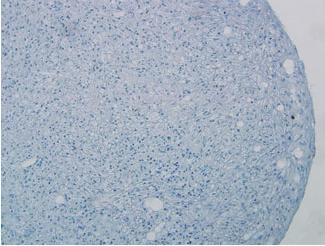 mesenchymal stem cells Neuronal Adipocytes