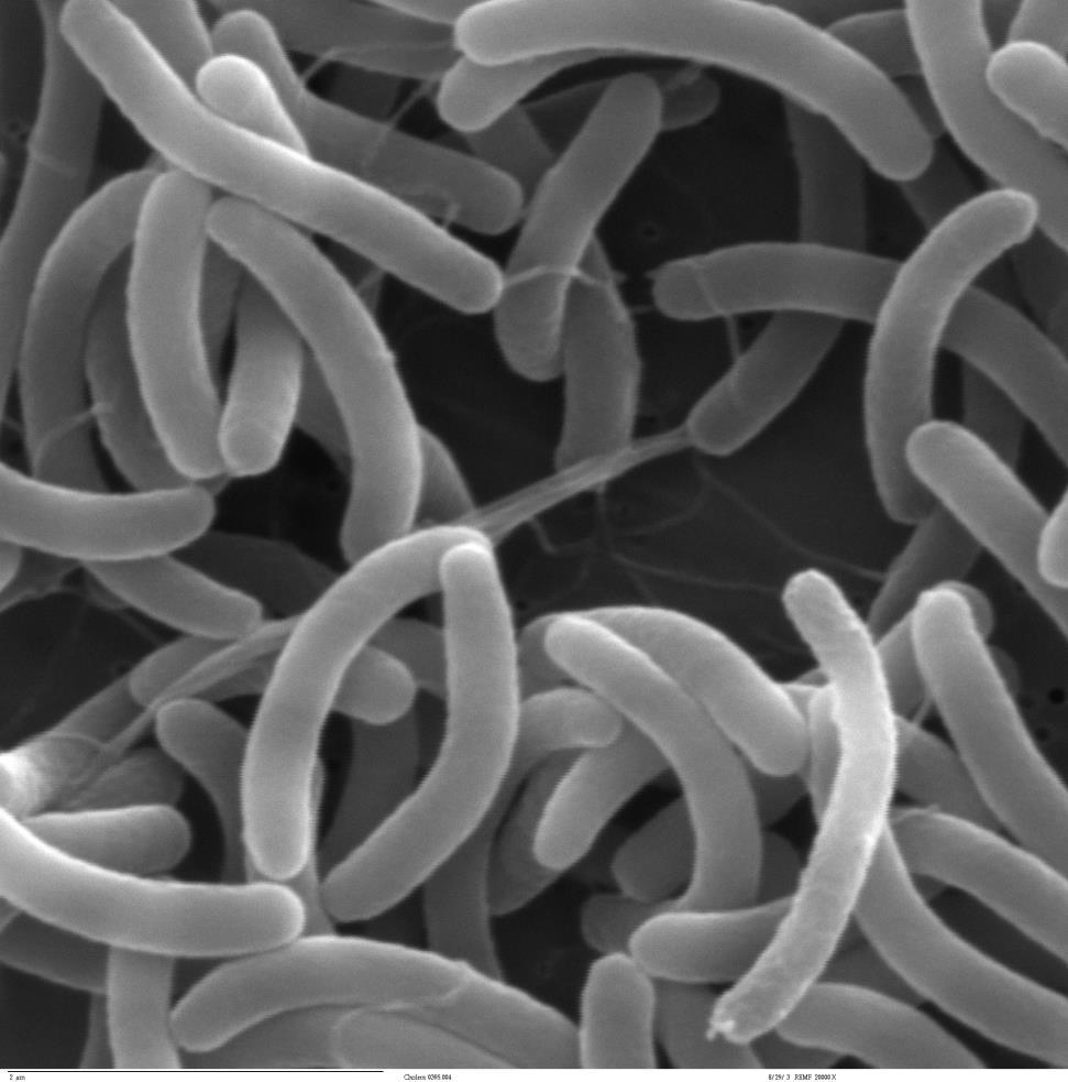 Bacteria Cholera: (Vibrio chlolerae) Tuberculosis: (Mycobacterium