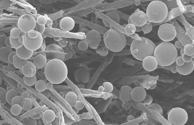 Scanning Electron Microscope (SEM) Positioning of capsules on surface of fibre Linkage microcapsules-fibers Capsule