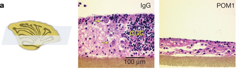 Cerebellar organotypic cultured slices show toxic effects of