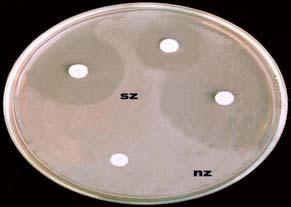 entire agar surface in three different directions to ensure an even distribution of the inoculum.