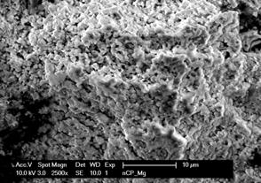 Nanophase Hydroxyapatite Coating on Mg Alloys 2.5 2 1.5 KCnt 1.5 O Mg P Ca/P Ratio =1.6 Ca Close to HA Ca/P Ratio =1.66 C Ca. 1. 2. 3.