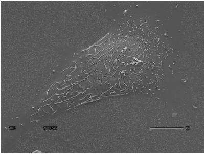 Bar=1 µm Bar=2 nm Promoted Osteoblast Infiltration into 3D Nanocomposites Cells SEM