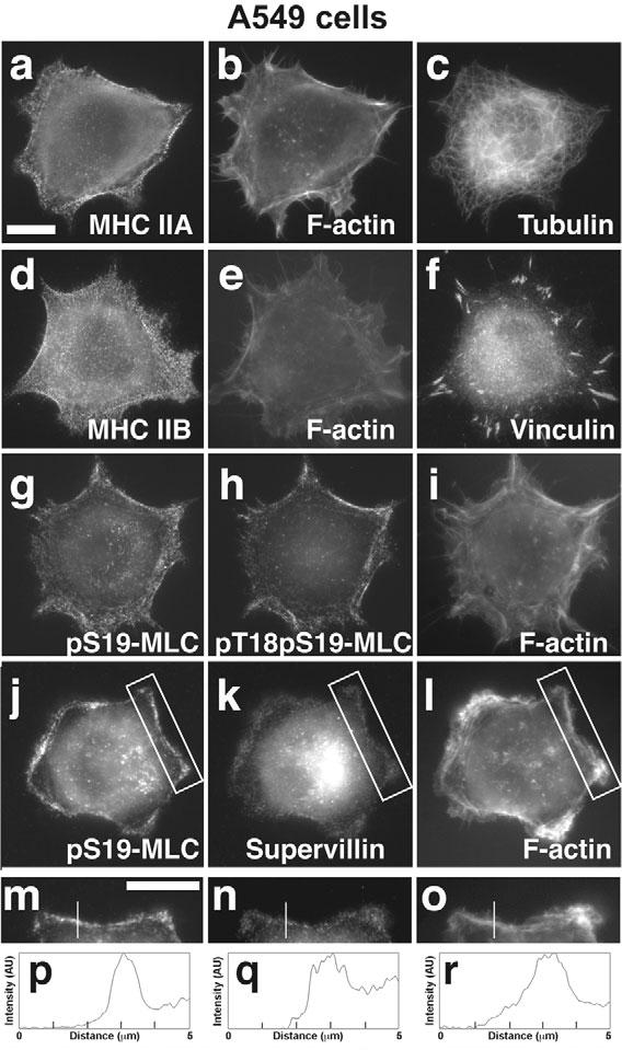 During early cell spreading, EGFP-SV and myosin heavy chain (MHC) IIB prominently co-localized in bundles at the cell periphery, in addition to their abundant signals in the cell interior (Fig.