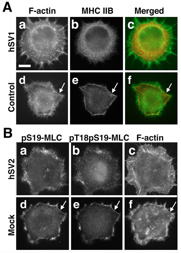 Activated myosin II filaments were still detectable with antibodies against mono- or doublyphosphorylated MLC, but these structures were more widely distributed throughout the cell cortex (Fig. 6B).