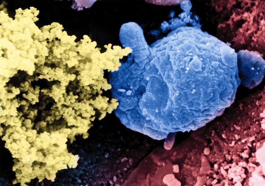 immune system (blue) tries to attack a soot particle and consume