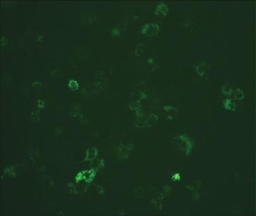 PMA induces the differentiation of THP-1 cells into phagocytic cells, measured by fluorescence microscopy.