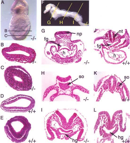FoxH1 specifies the anterior primitive streak Figure 3. FoxH1 mutant embryos have fused somites and a flat neural plate. (A) Lateral view of an E7.