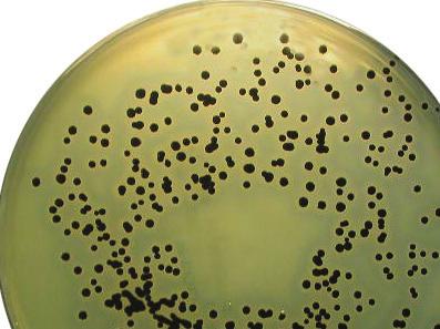 violet-elongated cells Germ tube production (presence of filaments with serum) Culture on Corn Meal Agar with 1% Polysorbate 80 (presence of Chlamydospores in a coverglass placed over the inoculun