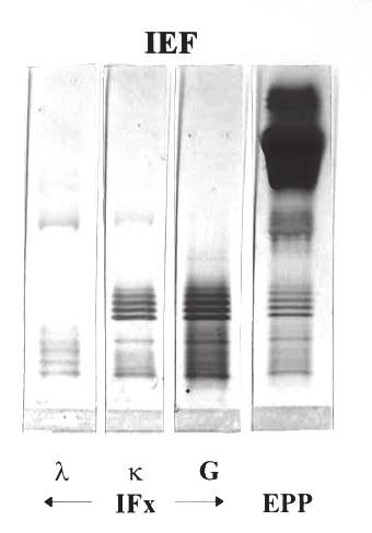 IEF and the bands to be a monoclonal IgG kappa band (M-protein) and oligoclonal IgG kappa and lambda bands (OB). protein electrophoresis in the post-transplant period.