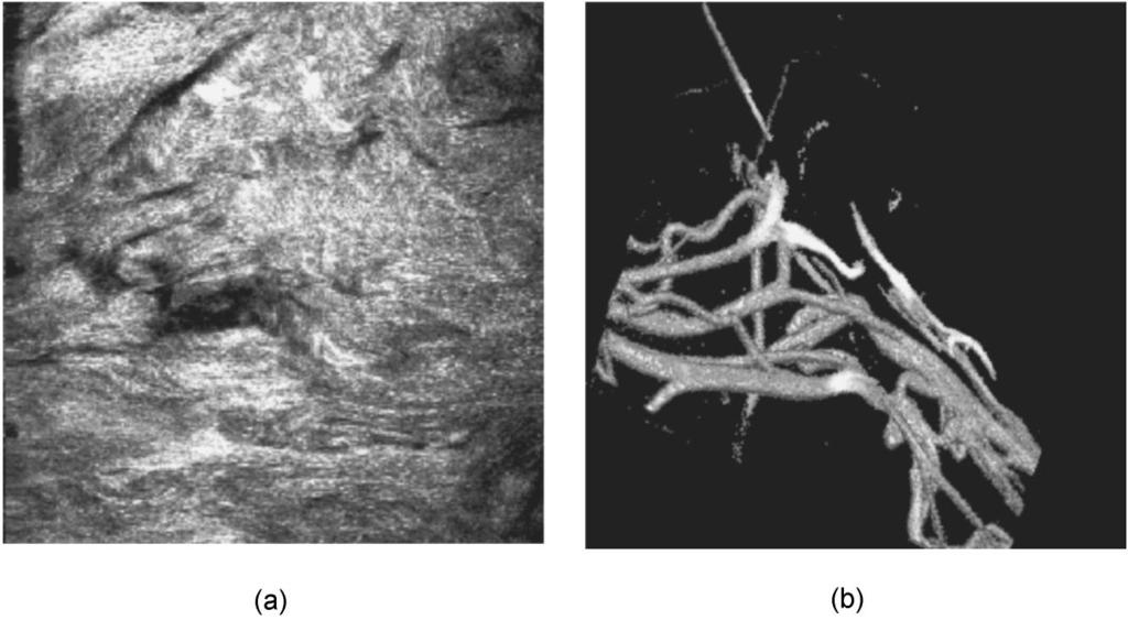 Two-photon 3-D mapping of ex vivo human skin... Fig. 6 Dermis 3-D reconstruction at emission wavelengths of (a) 400 and (b) 475 nm.