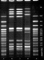 the enzymes in their own DNA Restriction enzymes Action of