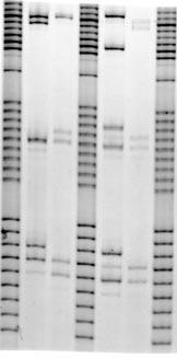 Lanes 1-4 contain individually amplified DNA samples and lanes labeled (L) contain a mixture of