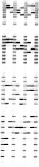 Lanes 1- contain individually amplified DNA samples and lanes labeled (L) contain a mixture of