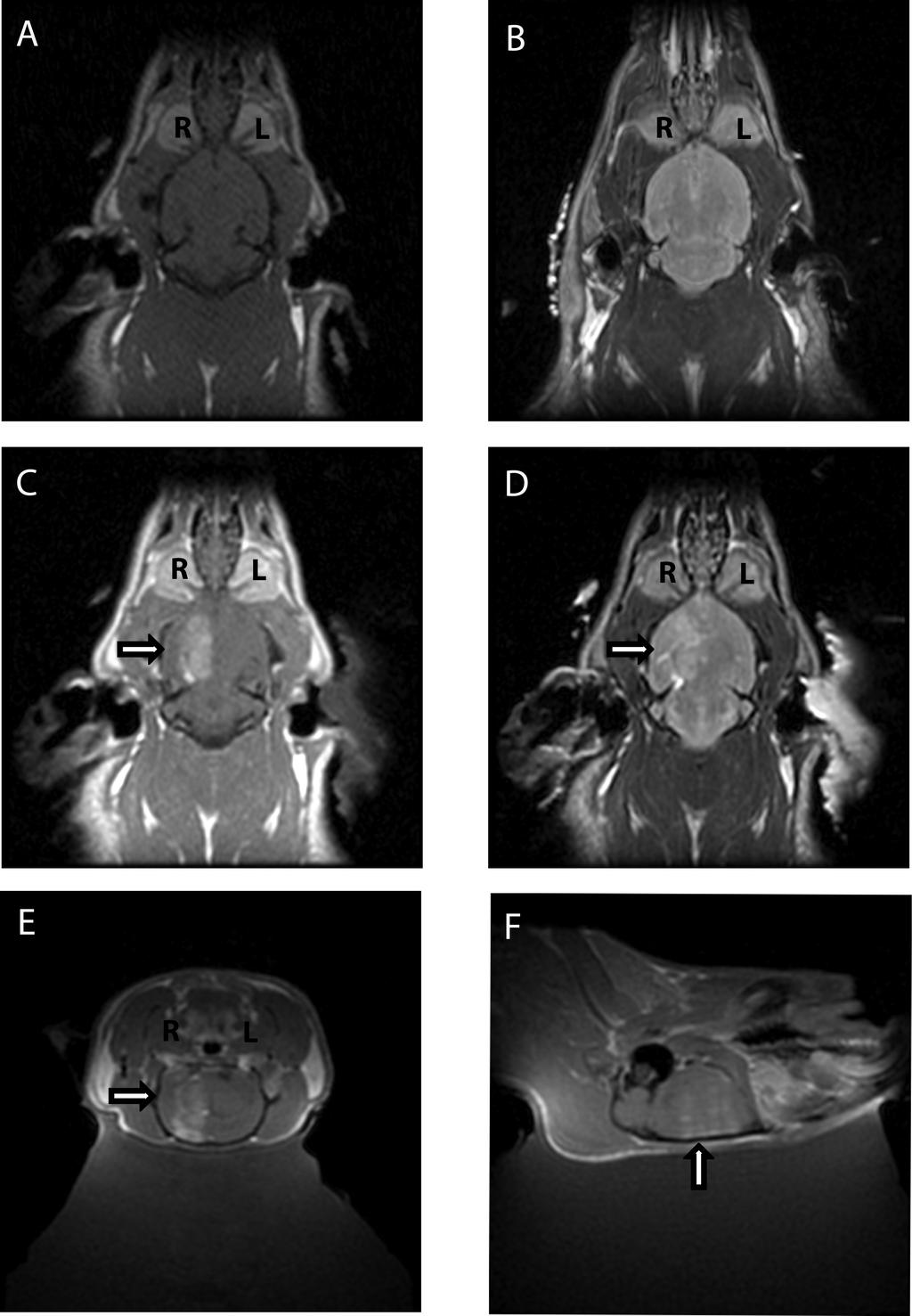 96 Figure 4.4. MRI demonstrating disruption of BBB by MRgFUS. (A) Contrast- enhanced axial T1- weighted images prior to MRgFUS do not show extravasations of gadolinium.