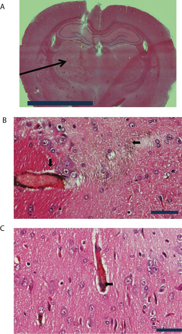 100 Figure 4.6. CNS localization of AuNP following of BBB disruption by MRIgFUS. (A) H&E histology of coronal section of the right and left frontal lobes.