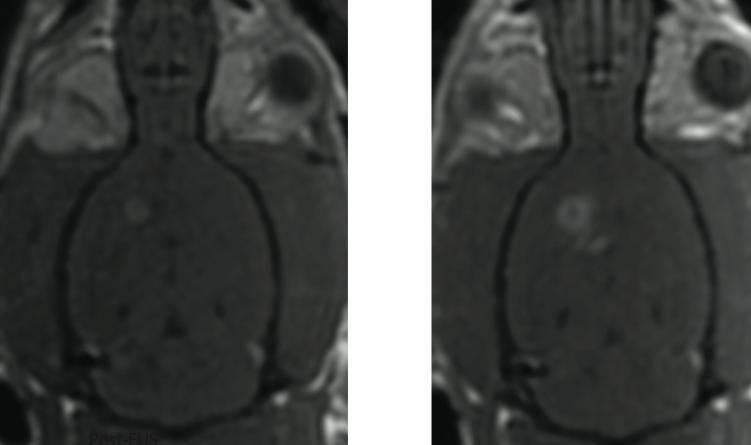 114 the brain parenchyma where the tumor invasive front is situated (Figure 4.12), whereas no delivery was noted in control animals that did not received FUS (Figure 4.13). Figure 4.11. Magnetic resonance imaging of MRgFUS disruption of the BBB around a brain glioma tumor graft.