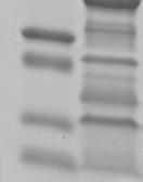 Strain Porins Mutations in genes (amino acid change) Amino acid changes in protein ompk35* ompk36* OmpK37 C2613 Wild GCT219ATCG, AAC220ACAC (A219S, N220H) Insertions: TERY after H237 and SSTNGG after