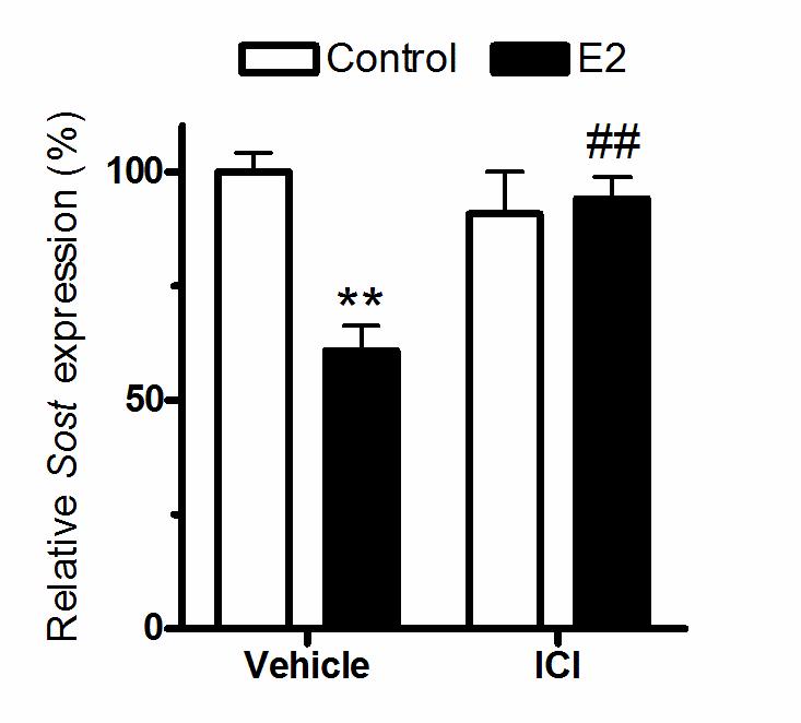 Supplementary Figure 5 Supplementary Figure 5: Inhibition of ERα and ERβ prevents Sost down-regulation by E2. Saos-2 cells were treated with 0.