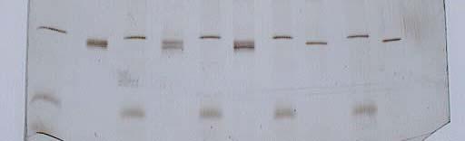 Silver-stained, SDS-PAGE gel Comparing IgG 1 purified by Protein G (row 1 from right) and