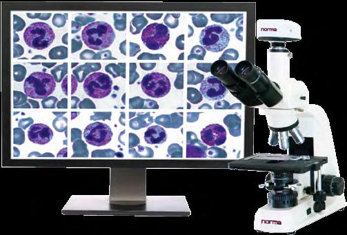 NormaVision M G Digital blood cell morphology for small and medium laboratories Help for lab technicians to find and capture blood cell images (WBC, RBC, PLT) Manual identification and automated