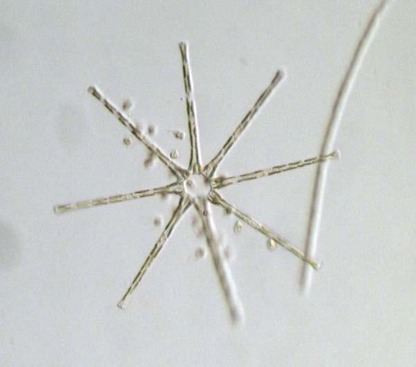 Types of Algae Diatoms Have hard shells made from silica Shells remain in