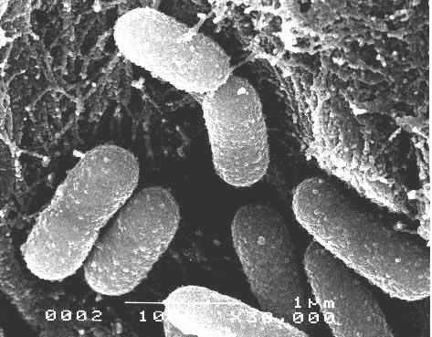 Bacteria found in urban and rural environments with no observable pattern Examples: E.