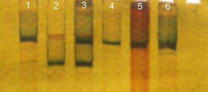 sometimes is required to know the purity of the extracted DNA. Proteins absorb UV light at 280nm. In a good DNA sample the ratio of OD at 260nm and 280nm should be above 1.8. Ratio below 1.
