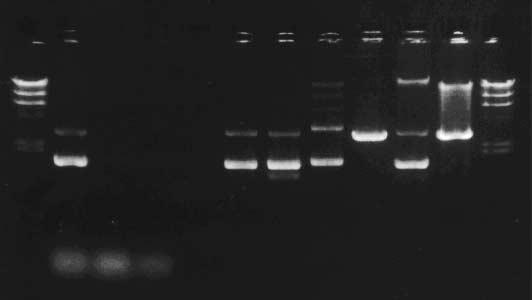 M L F W1 W2 E 1 2 3 4 5 M Figure 3 Agarose gel analysis of the plasmid purification procedure.