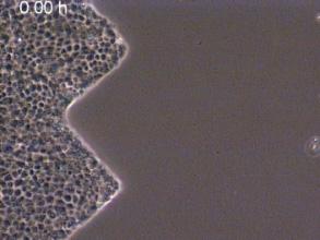 0 h B C 200 2θ l Cell