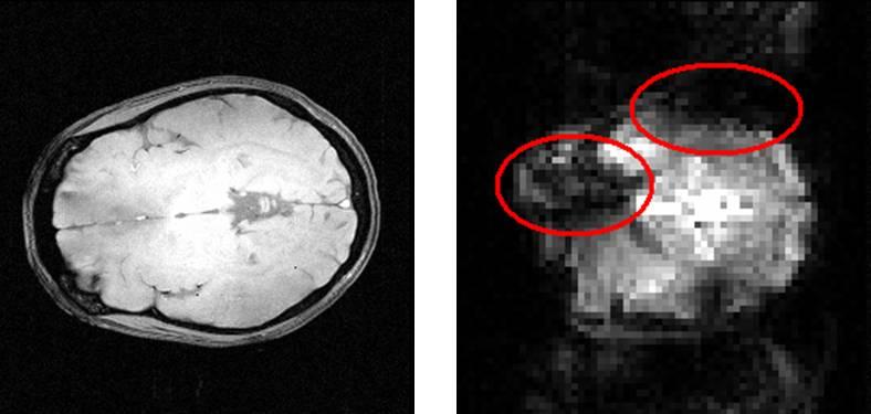 Fig. 2.7 shows axial images of the brain from an echo planar imaging (EPI) and a reference GRE sequence.