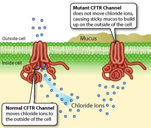 Cystic Fibrosis Cystic fibrosis is a common genetic disease caused by a mutation in a gene called the cystic fibrosis transmembrane conductance regulator (CFTR) gene.