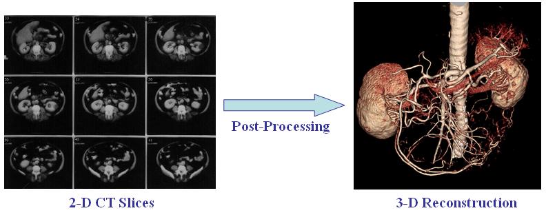 BIOMEDICAL SIGNAL AND IMAGE PROCESSING EE 5390-001
