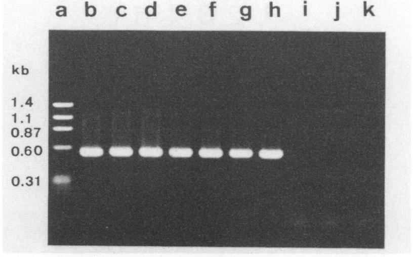 PCR products separated on a 2% agarose gel were transferred to a Hybond-N membrane (Amersham International plc.